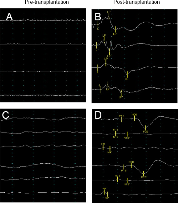神經電生理學改善 神經電生理學改善