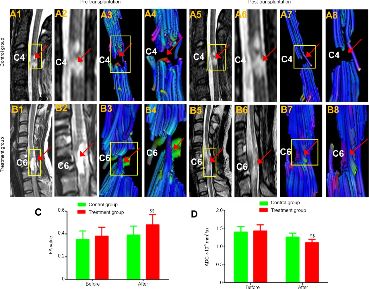 磁共振成像和擴散張量成像結果 磁共振成像和擴散張量成像結果