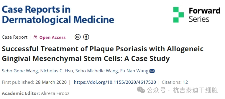 同種異體牙齦間充質(zhì)干細(xì)胞成功治療斑塊性銀屑病:案例研究 同種異體牙齦間充質(zhì)干細(xì)胞成功治療斑塊性銀屑病:案例研究