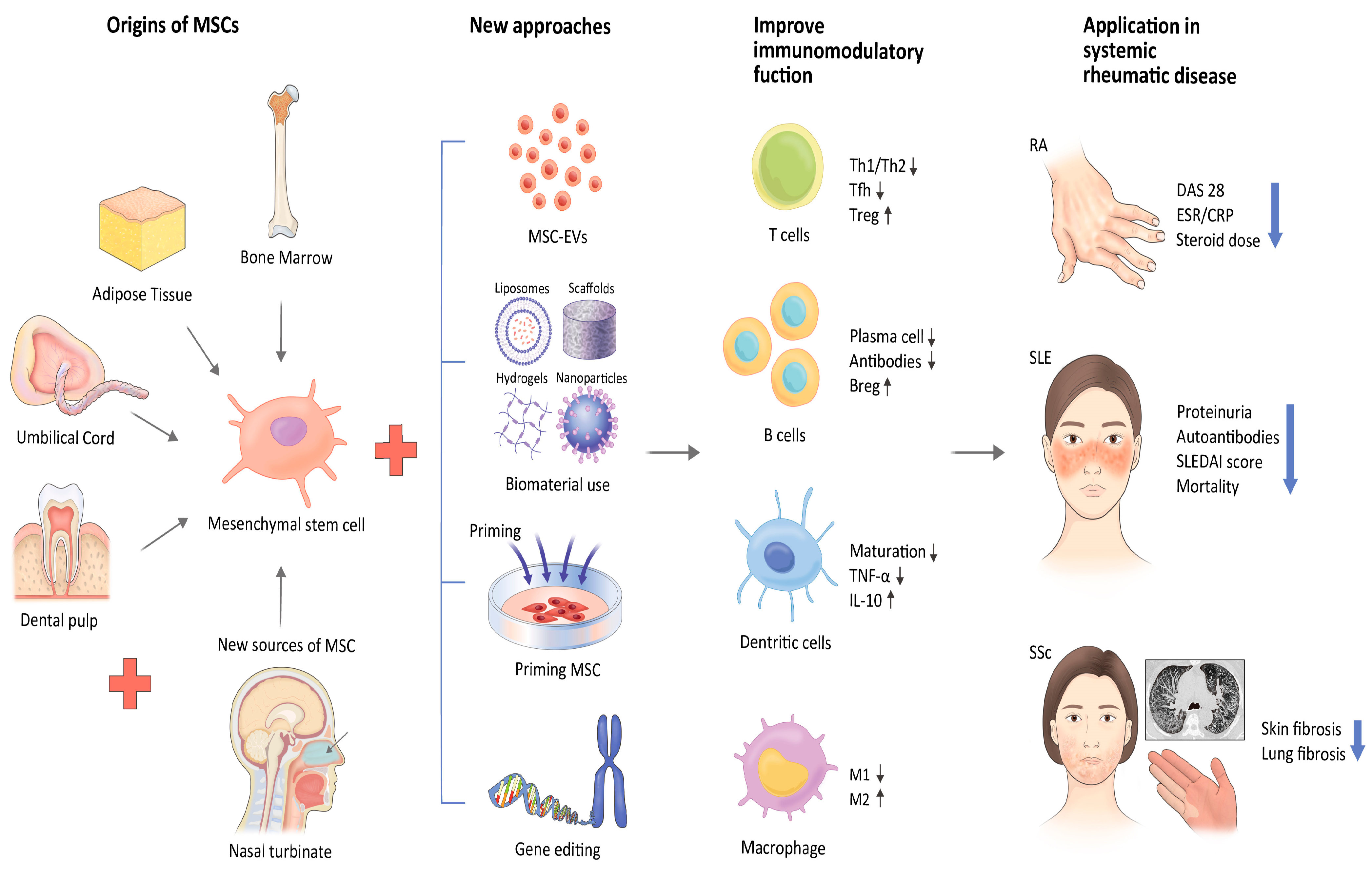 類風濕關節炎治療新方法:干細胞療法 類風濕關節炎治療新方法:干細胞療法
