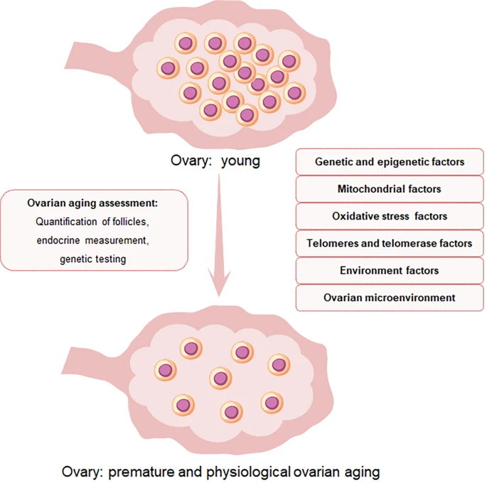 圖1:卵巢中卵泡數量和卵母細胞質量與POI的關系示意圖