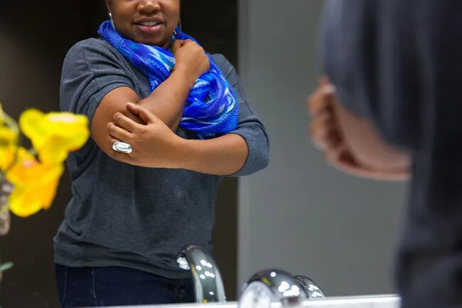 皮膚瘙癢 皮膚瘙癢