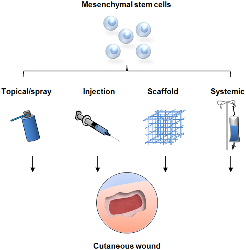 間充質(zhì)干細胞的治療方式有哪些—從傳統(tǒng)細胞移植到現(xiàn)代生物技術的應用 間充質(zhì)干細胞的治療方式有哪些—從傳統(tǒng)細胞移植到現(xiàn)代生物技術的應用