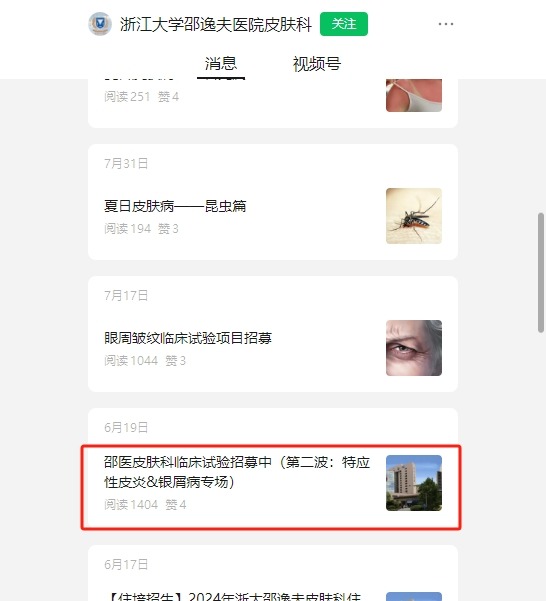 干細胞臨床招募:邵逸夫醫院招募特應性皮炎濕診患者參與治療! 干細胞臨床招募:邵逸夫醫院招募特應性皮炎濕診患者參與治療!