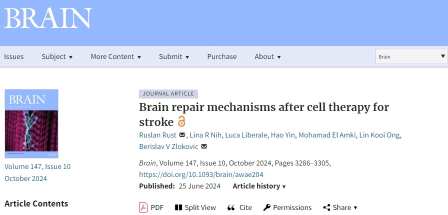 確認(rèn)干細(xì)胞治療中風(fēng)后的大腦修復(fù)機制,以推動干細(xì)胞治療中風(fēng)進(jìn)入臨床至關(guān)重要! 確認(rèn)干細(xì)胞治療中風(fēng)后的大腦修復(fù)機制,以推動干細(xì)胞治療中風(fēng)進(jìn)入臨床至關(guān)重要!