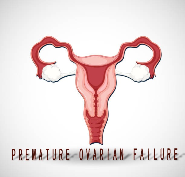 2020-2024年干細胞治療卵巢早衰患者臨床研究進展