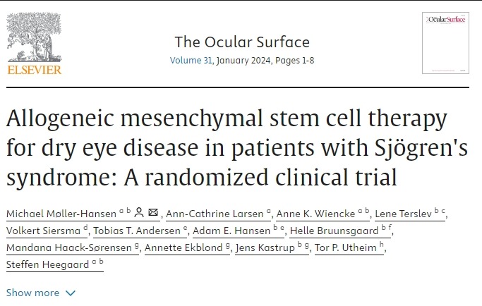 同種異體間充質干細胞治療干燥綜合征患者干眼癥:一項隨機臨床試驗 同種異體間充質干細胞治療干燥綜合征患者干眼癥:一項隨機臨床試驗