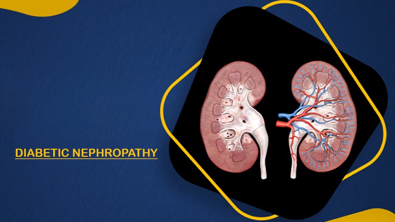 干細胞治療糖尿病腎病的安全性怎么樣?盤點國內(nèi)外臨床進展! 干細胞治療糖尿病腎病的安全性怎么樣?盤點國內(nèi)外臨床進展!