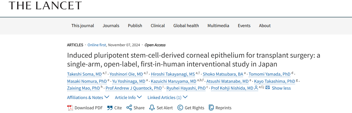 《誘導(dǎo)性多能干細(xì)胞來(lái)源的角膜上皮用于移植手術(shù):日本的一項(xiàng)單臂、開放標(biāo)簽、首次人體介入研究》 《誘導(dǎo)性多能干細(xì)胞來(lái)源的角膜上皮用于移植手術(shù):日本的一項(xiàng)單臂、開放標(biāo)簽、首次人體介入研究》
