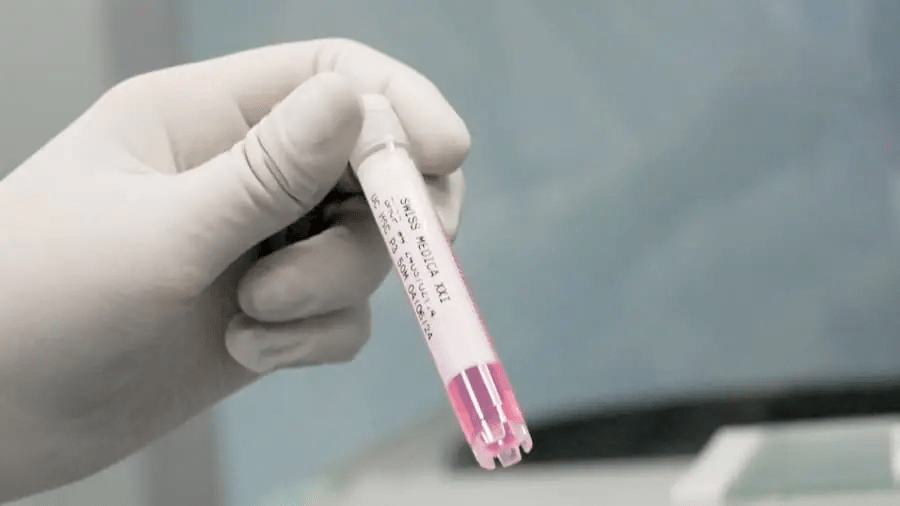 干細胞治療程序:??完整流程和所有步驟!