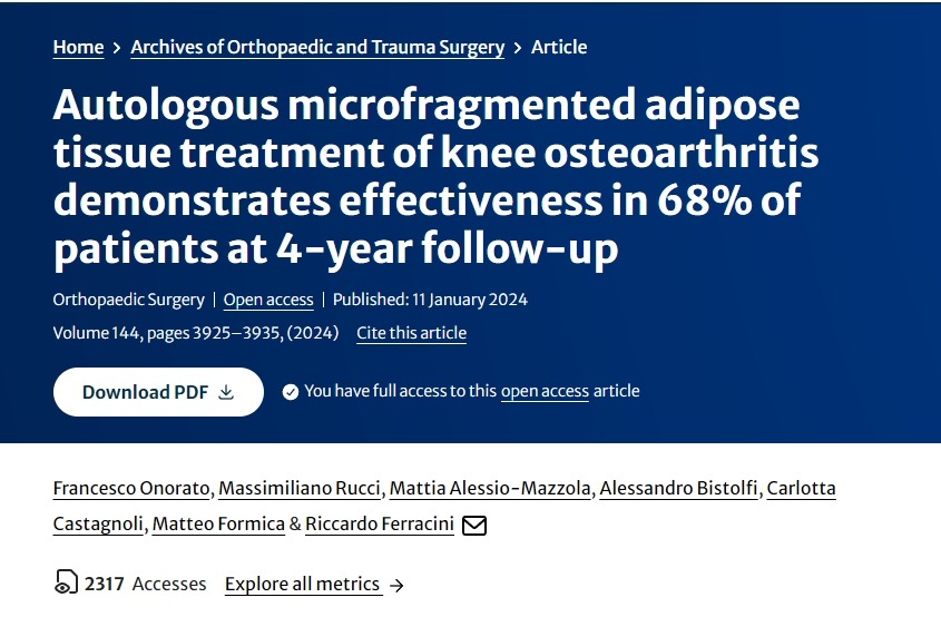 自體微碎片脂肪組織治療膝關節骨關節炎在4年隨訪中顯示對68%的患者有效 自體微碎片脂肪組織治療膝關節骨關節炎在4年隨訪中顯示對68%的患者有效