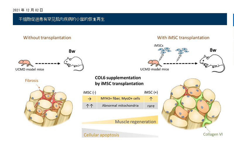 2021年干細胞治療肌肉萎縮癥臨床案例 2021年干細胞治療肌肉萎縮癥臨床案例
