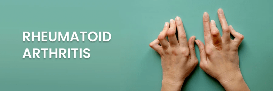 2024年最新進展報告:干細胞療法為類風濕關節炎帶來希望之光 2024年最新進展報告:干細胞療法為類風濕關節炎帶來希望之光