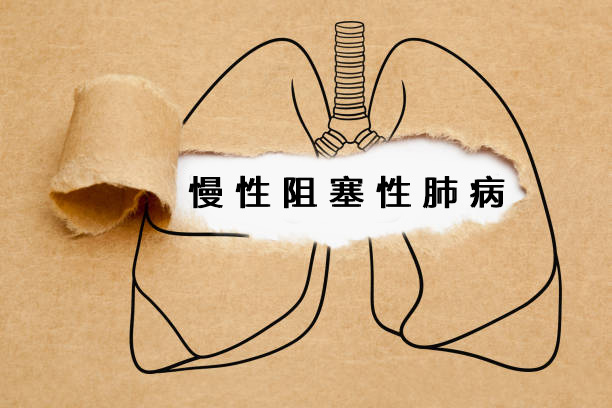 2024年干細(xì)胞治療慢阻肺的最新研究進(jìn)展盤(pán)點(diǎn) 2024年干細(xì)胞治療慢阻肺的最新研究進(jìn)展盤(pán)點(diǎn)