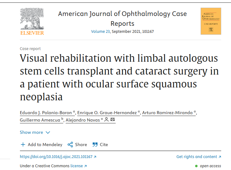 眼表鱗狀細胞瘤患者角膜緣自體干細胞移植及白內(nèi)障手術進行視力康復 眼表鱗狀細胞瘤患者角膜緣自體干細胞移植及白內(nèi)障手術進行視力康復