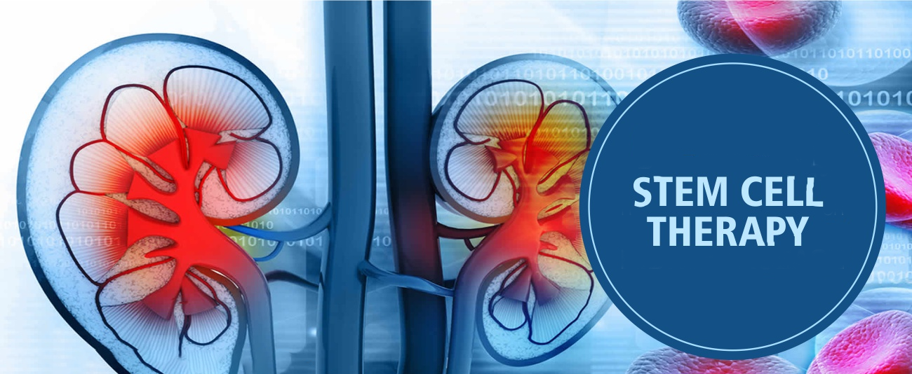 干細胞治療腎臟疾病的6大原理機制，您都了解嗎？