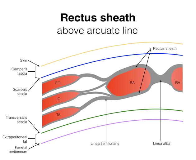 腹直肌前鞘下移植 腹直肌前鞘下移植