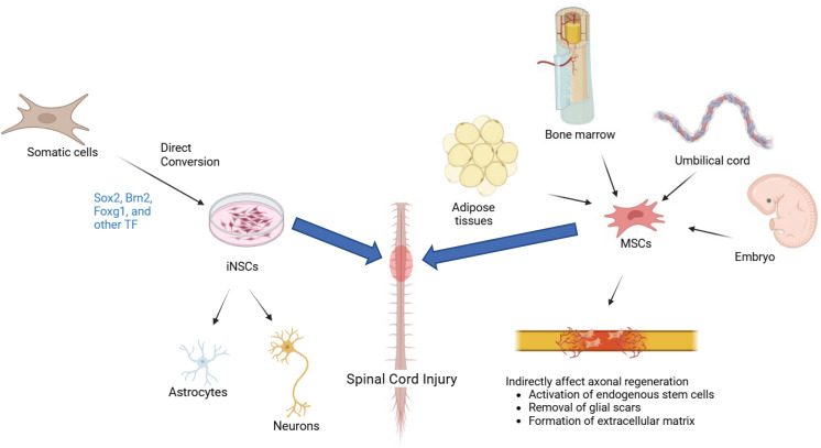 圖1:iNSC(左)和 MSC(右)的比較:由體細胞重新編程的iNSC專注于神經元再生和神經營養(yǎng)支持,而來自骨髓、脂肪或臍帶的MSC提供抗炎、免疫調節(jié)作用和細胞外基質重塑,用于脊髓損傷修復。 圖1:iNSC(左)和 MSC(右)的比較:由體細胞重新編程的iNSC專注于神經元再生和神經營養(yǎng)支持,而來自骨髓、脂肪或臍帶的MSC提供抗炎、免疫調節(jié)作用和細胞外基質重塑,用于脊髓損傷修復。