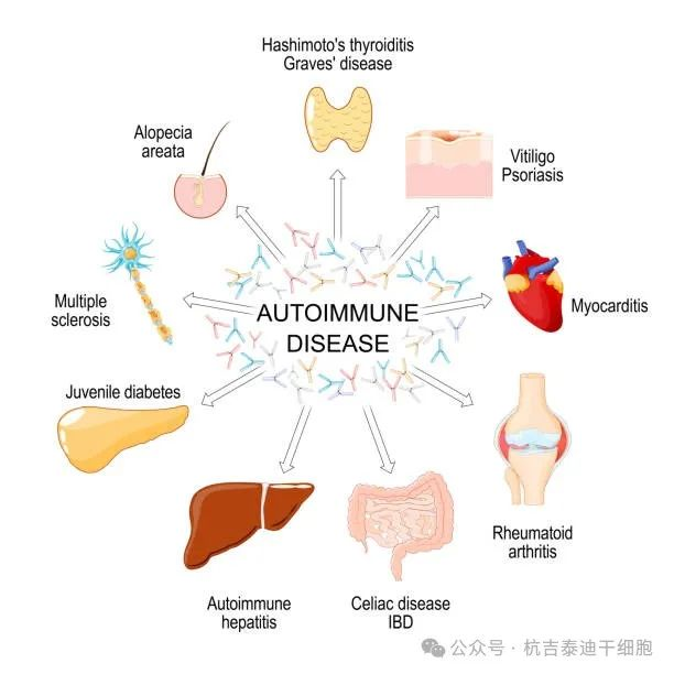 自身免疫性疾病的種類 自身免疫性疾病的種類