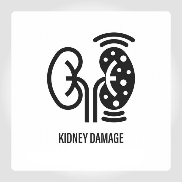 干細胞療法:扭轉腎病患者癥狀的關鍵力量 干細胞療法:扭轉腎病患者癥狀的關鍵力量