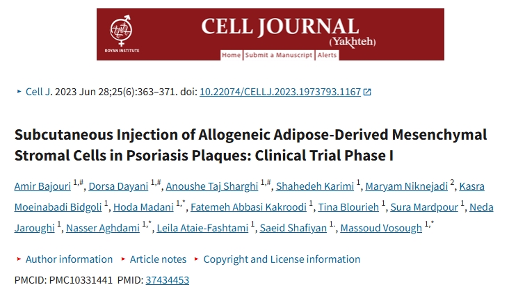 銀屑病斑塊中同種異體脂肪間充質(zhì)基質(zhì)細(xì)胞的皮下注射:臨床試驗I期 銀屑病斑塊中同種異體脂肪間充質(zhì)基質(zhì)細(xì)胞的皮下注射:臨床試驗I期