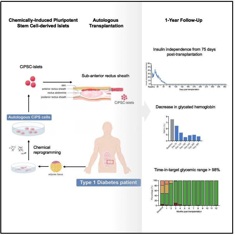圖1:基于CiPS細(xì)胞治療1型糖尿病的臨床研究的示意圖和治療效果
