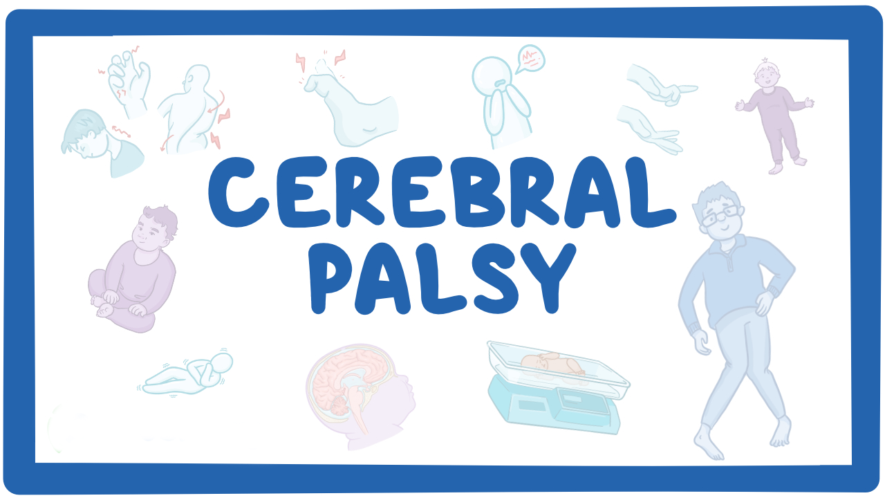 孩子腦癱有救了?神經干細胞移植治療腦癱的真實療效分享 孩子腦癱有救了?神經干細胞移植治療腦癱的真實療效分享