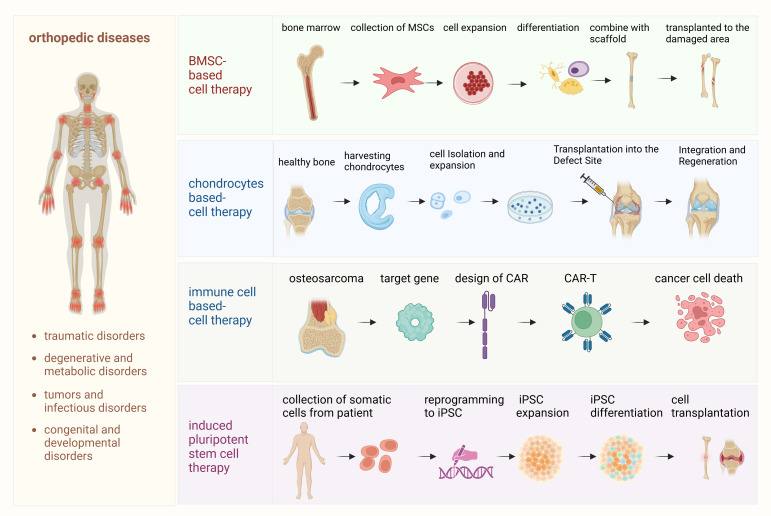 圖1:骨科疾病細(xì)胞療法的詳細(xì)流程。該圖概述了用于治療骨科疾病的各種細(xì)胞療法所涉及的逐步流程。 圖1:骨科疾病細(xì)胞療法的詳細(xì)流程。該圖概述了用于治療骨科疾病的各種細(xì)胞療法所涉及的逐步流程。
