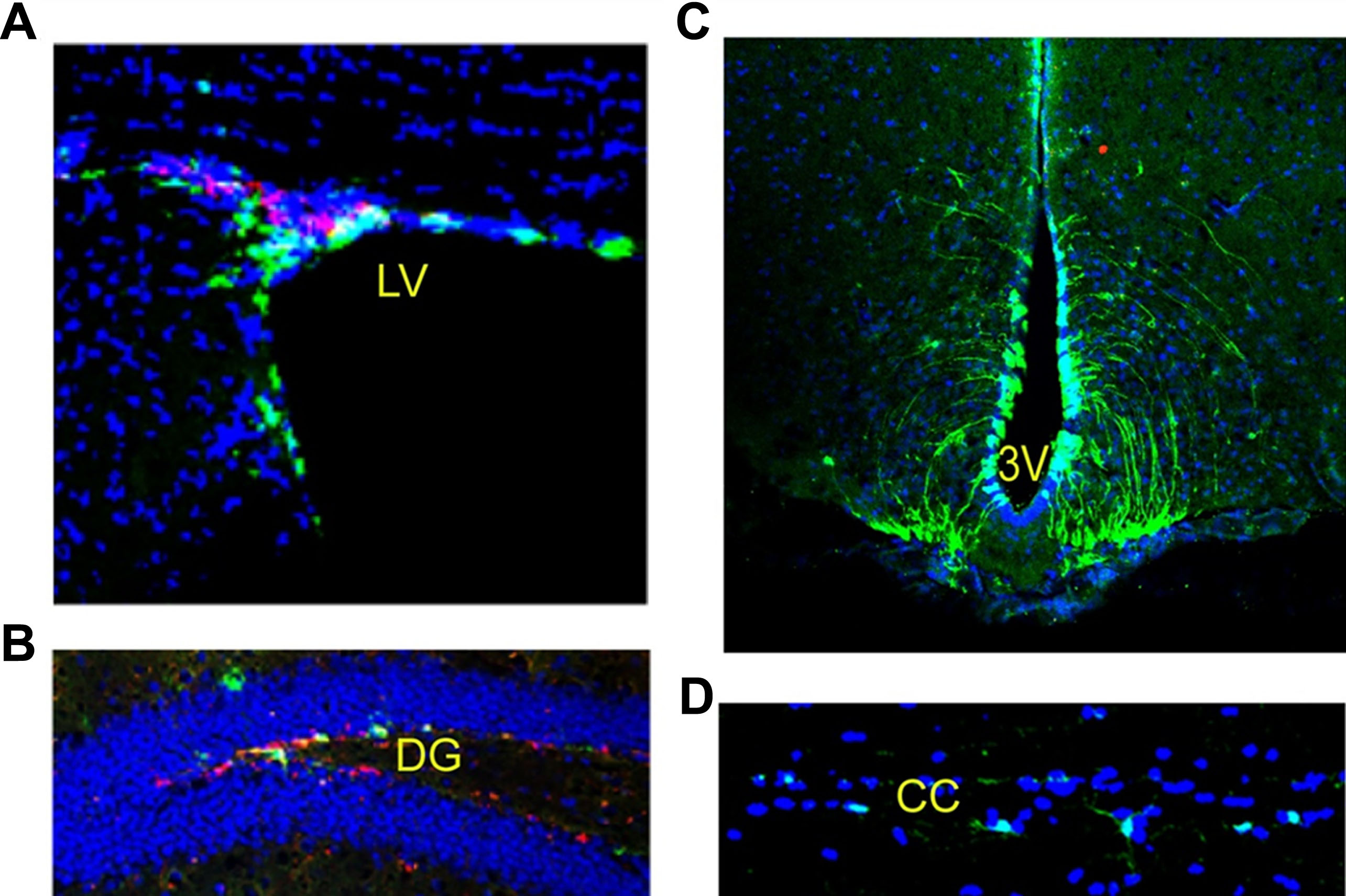 圖2:成年小鼠腦和脊髓中的神經干細胞:左腦 (LV)、第三腦室 (DG)、齒狀回 (DG) 和脊髓。 圖2:成年小鼠腦和脊髓中的神經干細胞:左腦 (LV)、第三腦室 (DG)、齒狀回 (DG) 和脊髓。