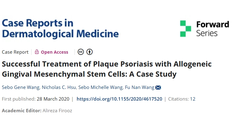 同種異體牙齦間充質干細胞成功治療斑塊性銀屑病:案例研究 同種異體牙齦間充質干細胞成功治療斑塊性銀屑病:案例研究