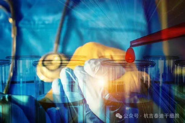 一名RA/MS患者經過CAR-T治療失敗后,經過自體干細胞移植后,主觀健康狀態顯著改善! 一名RA/MS患者經過CAR-T治療失敗后,經過自體干細胞移植后,主觀健康狀態顯著改善!