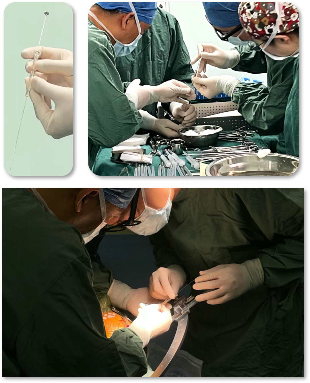 手術(shù)流程 手術(shù)流程