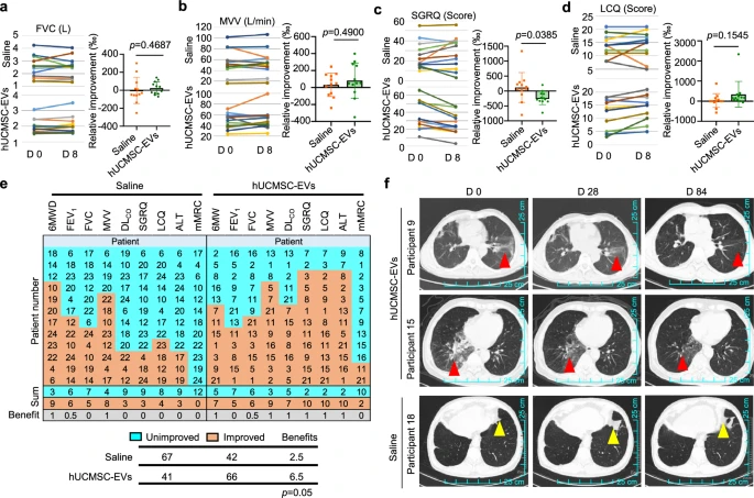 圖5:霧化吸入hUCMSC-EVs治療肺纖維化的臨床療效 圖5:霧化吸入hUCMSC-EVs治療肺纖維化的臨床療效