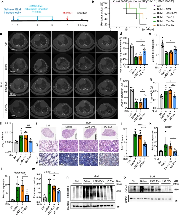圖2:霧化 hUCMSC-EVs 治療小鼠損傷性肺纖維化的療效。 圖2:霧化 hUCMSC-EVs 治療小鼠損傷性肺纖維化的療效。