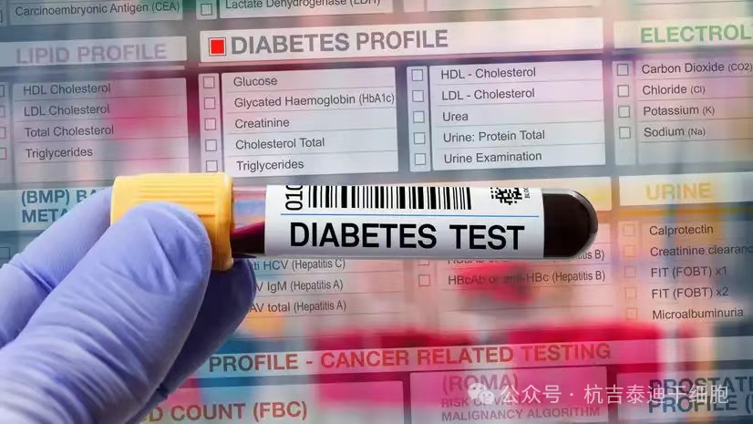 突破性干細胞療法Zimislecel:83%重癥糖尿病患者停用胰島素超一年 突破性干細胞療法Zimislecel:83%重癥糖尿病患者停用胰島素超一年