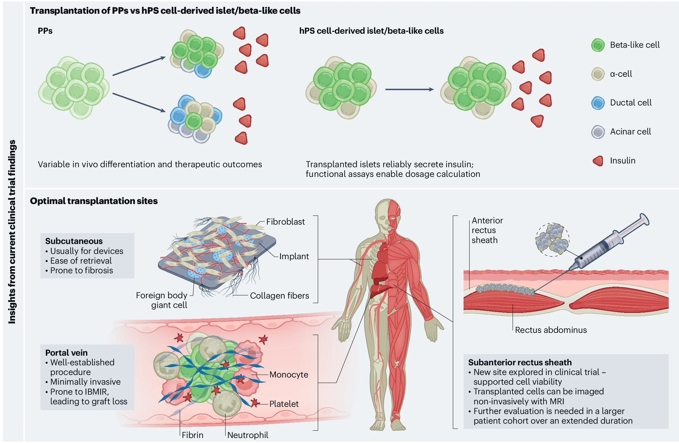 圖2:最新干細胞治療糖尿病的創(chuàng)新和經(jīng)驗教訓 圖2:最新干細胞治療糖尿病的創(chuàng)新和經(jīng)驗教訓