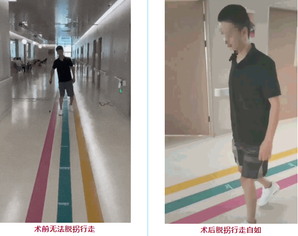 干細(xì)胞治療脊髓損傷臨床項目 干細(xì)胞治療脊髓損傷臨床項目