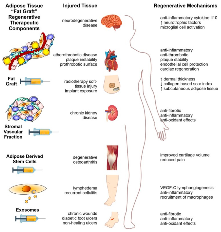 圖2:本文以示意圖形式概述了利用脂肪組織脂肪治療人類疾病的方法。 圖2:本文以示意圖形式概述了利用脂肪組織脂肪治療人類疾病的方法。