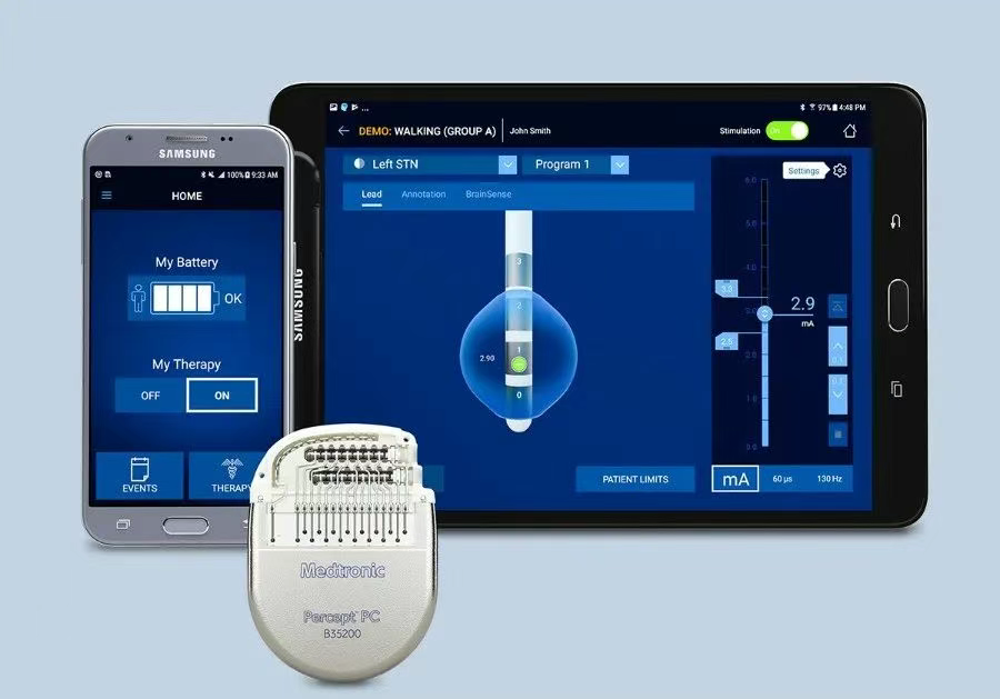 美敦力推出的BrainSense?自適應腦深部刺激(aDBS)系統 美敦力推出的BrainSense?自適應腦深部刺激(aDBS)系統