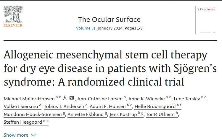 異基因間充質(zhì)干細(xì)胞治療干燥綜合征患者干眼癥:一項隨機臨床試驗 異基因間充質(zhì)干細(xì)胞治療干燥綜合征患者干眼癥:一項隨機臨床試驗