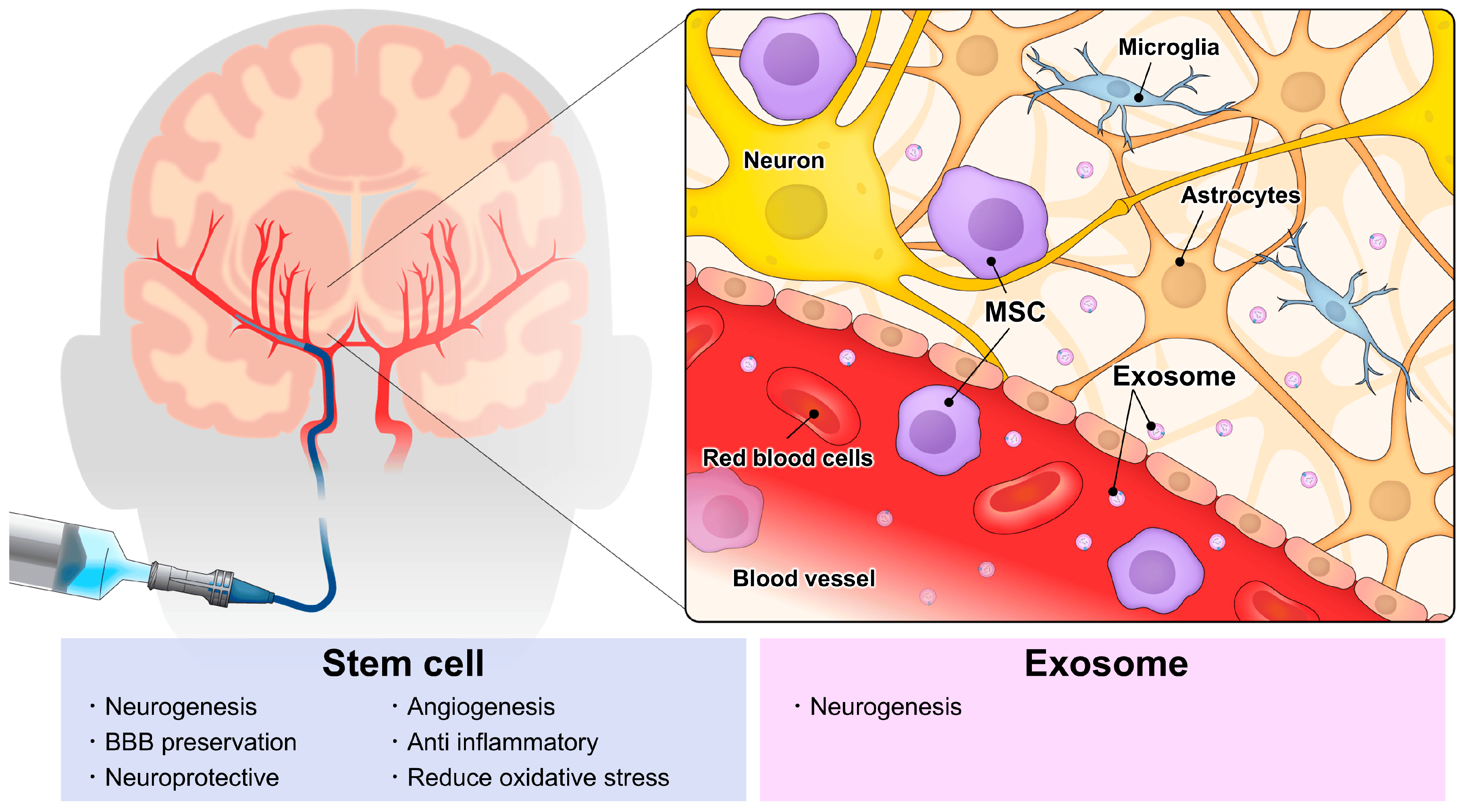 動(dòng)脈注射干細(xì)胞&外泌體治療神經(jīng)系統(tǒng)疾病,打多少細(xì)胞合適?什么時(shí)候移植好? 動(dòng)脈注射干細(xì)胞&外泌體治療神經(jīng)系統(tǒng)疾病,打多少細(xì)胞好?
