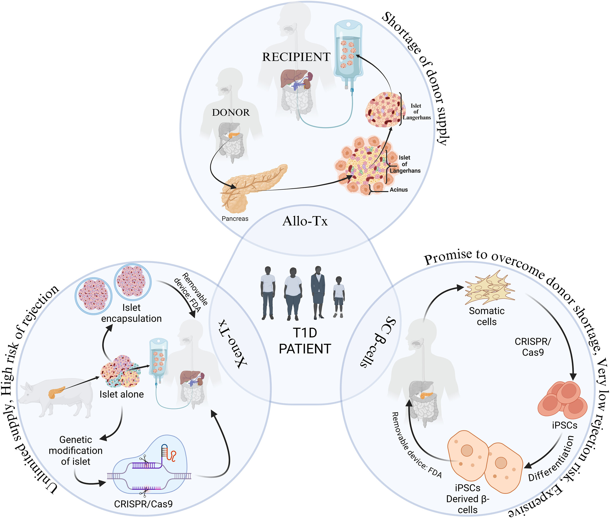 圖1:1型糖尿病 (T1D) 中胰島β細(xì)胞替代的可能細(xì)胞和分子策略。 圖1:1型糖尿病 (T1D) 中胰島β細(xì)胞替代的可能細(xì)胞和分子策略。