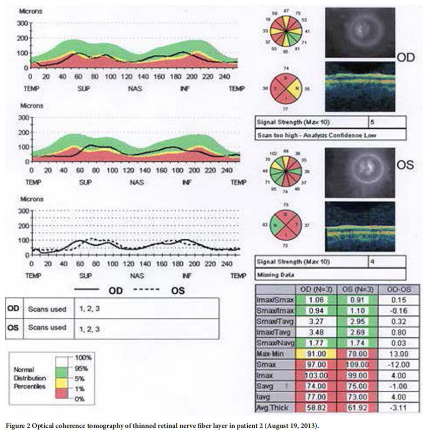 遺傳性視神經病變臨床試驗 遺傳性視神經病變臨床試驗