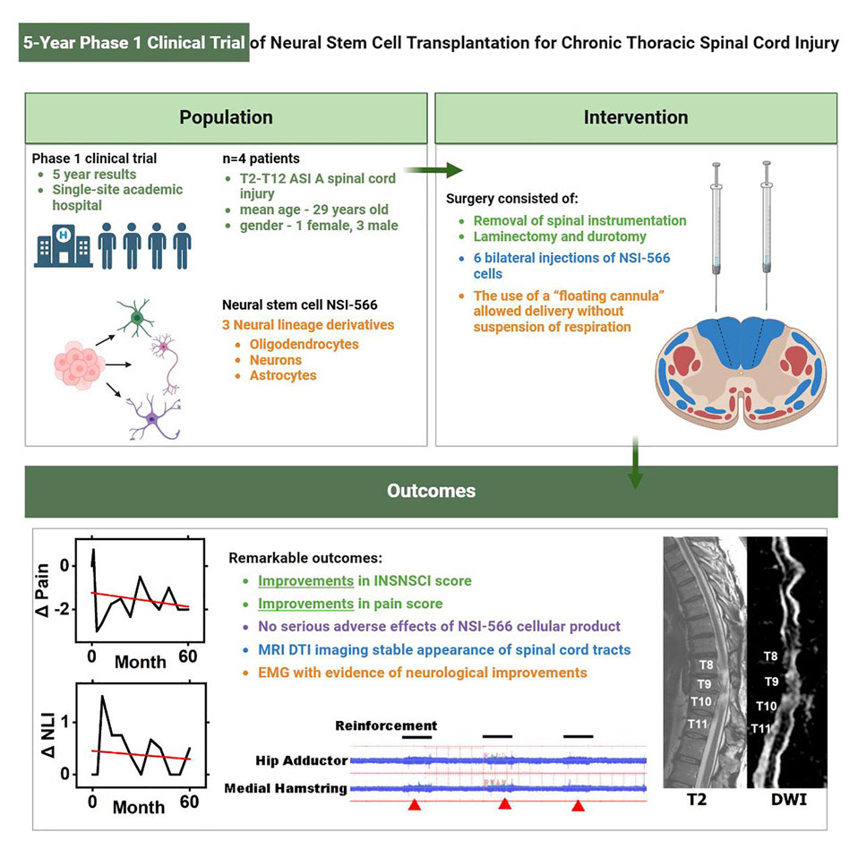 干細胞治療脊髓損傷 干細胞治療脊髓損傷