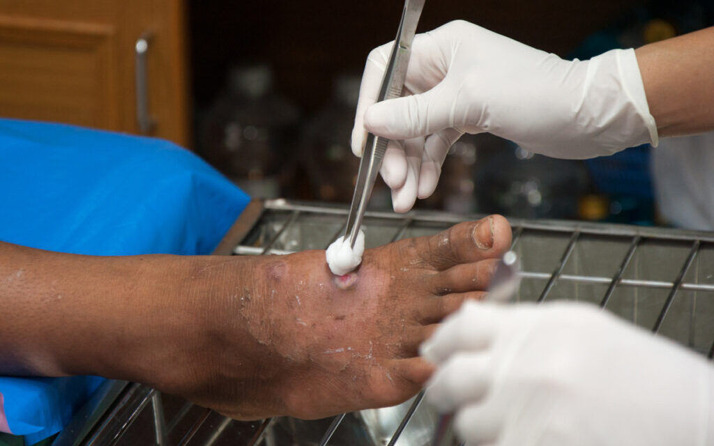 干細(xì)胞治療 干細(xì)胞治療