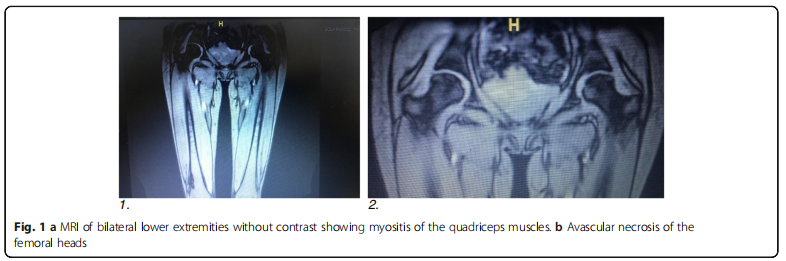 干細胞移植 干細胞移植