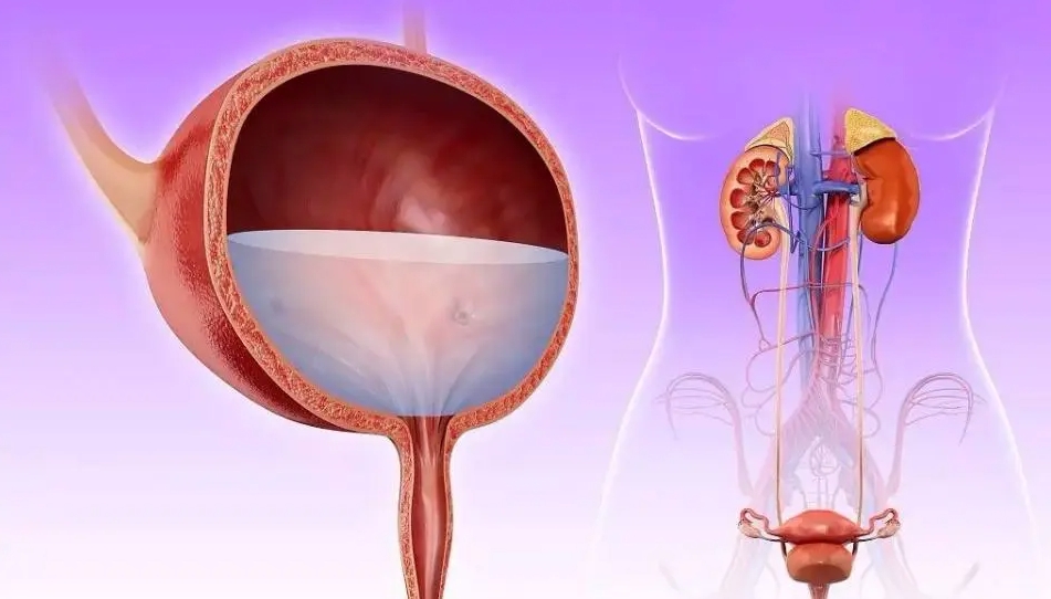 逼尿肌收縮力減退 逼尿肌收縮力減退