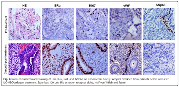 臨床試驗(yàn) 臨床試驗(yàn)
