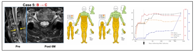 臨床試驗 臨床試驗