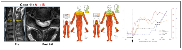 臨床試驗 臨床試驗